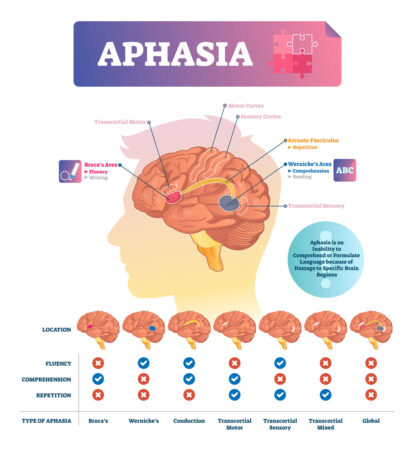 illustration depicting aphasia