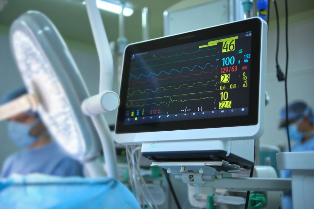 EKG monitor in hospital